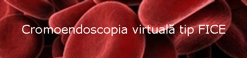 Cromoendoscopia virtual� tip FICE