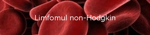 Limfomul non-Hodgkin